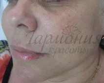 меките тъкани меките тъкани