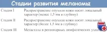 Операція при меланомі та її ефективність хворих