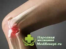 симптоми симптоми