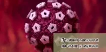 папиломи пениса