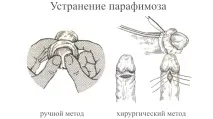 таке