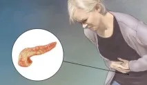 панкреатит панкреатит