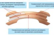 Пластир від хропіння огляд та принцип дії продукту огляд