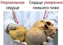 алкохолизъм бирен