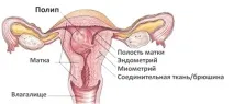 рискове полип