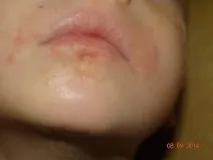 причините причините
