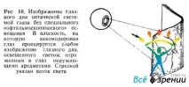 Принцип роботи офтальмоскопічних систем систем
