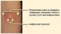 манту деца