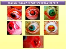 очите наранявания