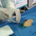 Рентгенендоваскулярна хірургія у кардіології хірургія