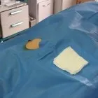 Рентгенендоваскулярна хірургія у кардіології кардіології