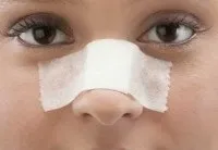 Ринопластика особливості процедури та її проведення особливості