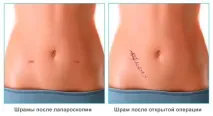 справим