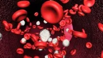 Синдром Чедіака Хігасі причини, діагностика, симптоми та лікування фото синдром