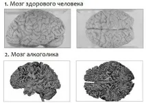 причини лечение