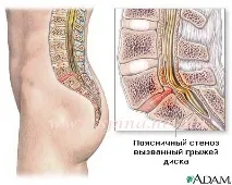 спинална спинална