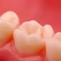 Світлова пломба ціна від 1500 руб 1500