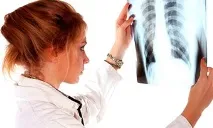 Тест Oncotype DX Breast, Діагностика раку грудей в Ізраїлі тест