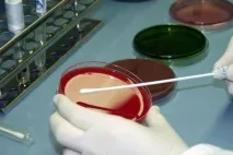 Трихомоніаз у жінок симптоми та перші ознаки, чим лікувати жінок