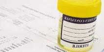 Урати в сечі у великій кількості що це означає кількості