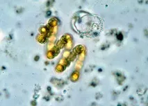 У ціанобактерій виявили - зір Synechocystis