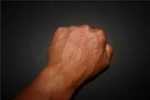 сърцето лечение