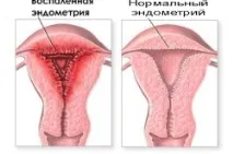 воднисто воднисто