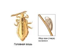 въшки гниди въшките гнидите