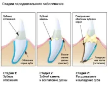 хирургично официален