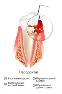 хирургично хирургично