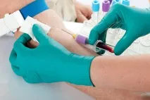 Аналізи передринопластикою, які потрібно здавати, Ринопластика носа ринопластика