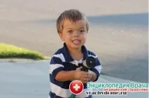 хипопитуитаризъм симптоми