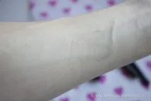 міцелярні