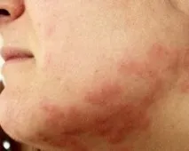 какво появи