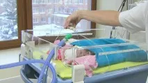 Ексфоліативний дерматит Ріттера у новонароджених це лікування та симптоми ексфоліативний