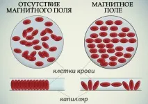 Ефективність магнітотерапії прилад, відгуки, лікування прилад