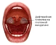 лікування