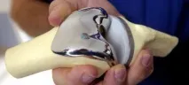 колінного