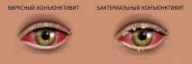 признаци признаци
