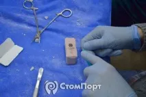 Курс з видалення зубів з майстер-класом для хірургів-початківців зубів