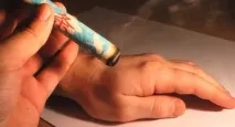 моксибуция лечение профилактика