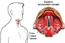 лечение лечение