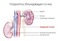 правої