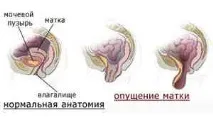 бременност раждане