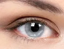 лещи Ophthalmix Colors лещи Ophthalmix