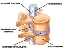 тренировките остеохондроза
