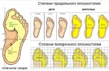 симптоми