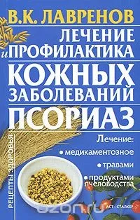 Псоріаз, профілактика та лікування профілактика