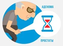 простатата аденом