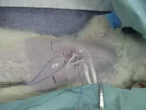 гърдите
